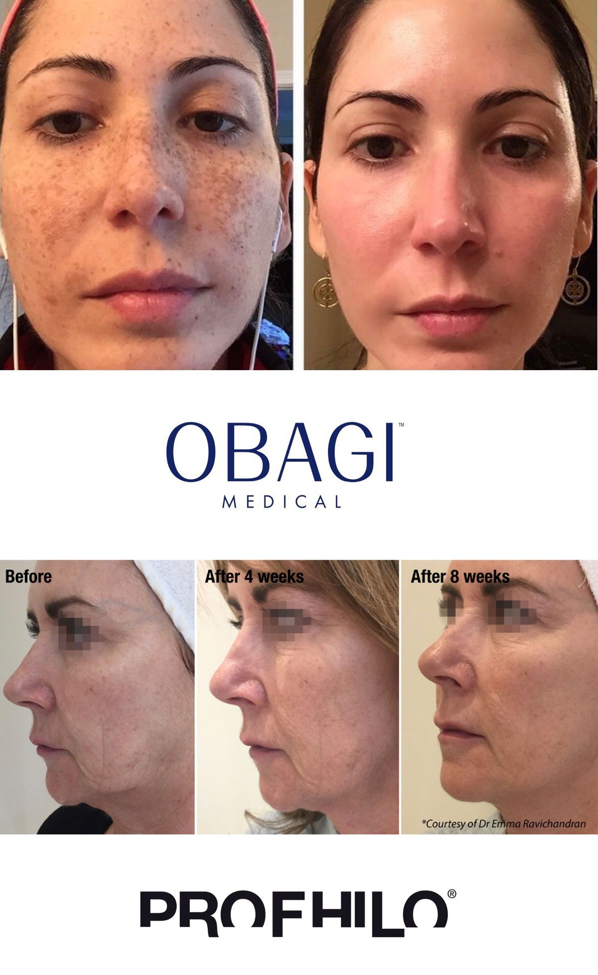 Winter Skin Package Before and After